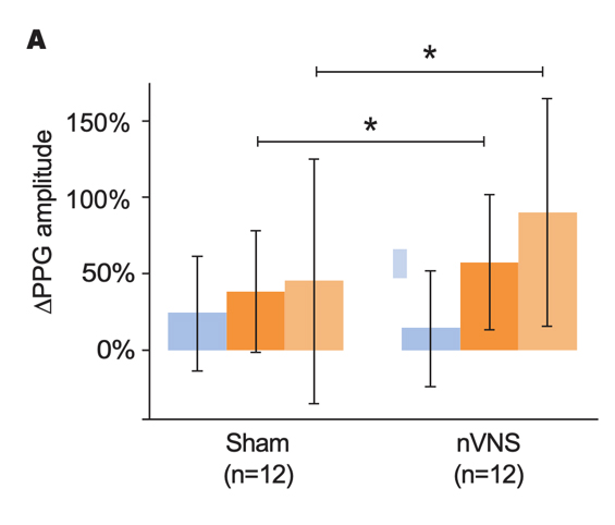 Primary Outcomes From Physiological Signal Analyses for Stimulation Following Traumatic Stress