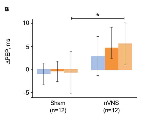 Primary Outcomes From Physiological Signal Analyses for Stimulation Following Traumatic Stress