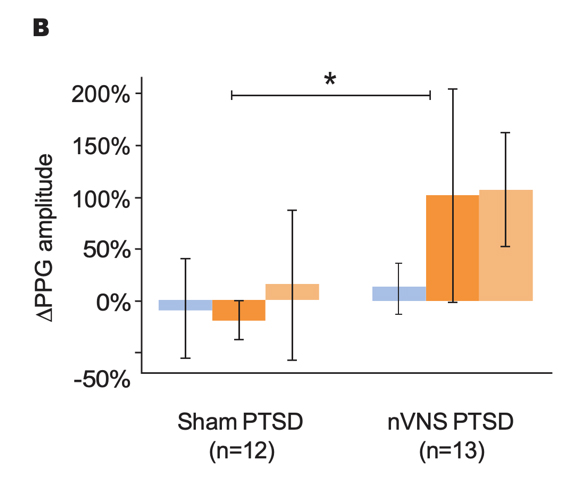 Outcomes for Active nVNS and Sham Stimulation Following Traumatic Stress in Patients With PTSD