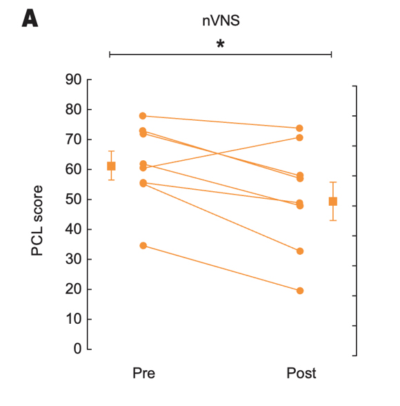 Effects of up to 3 Months of Twice-Daily nVNS or Sham Stimulation on Symptoms of PTSD as Measured